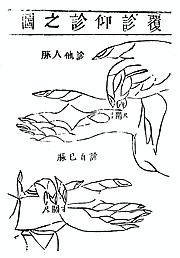 TCM Palpitation Chart